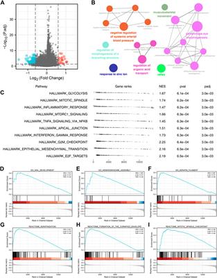 Comprehensive analysis illustrating the role of PANoptosis-related genes in lung cancer based on bioinformatic algorithms and experiments